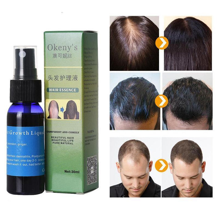 Sunburst Hair Growth Products for women&men